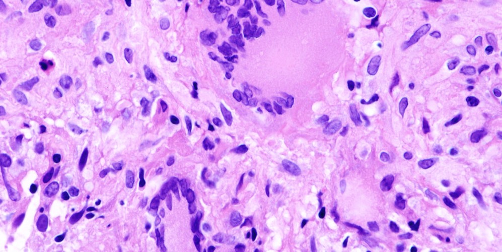 @gheacin@mastodon.social